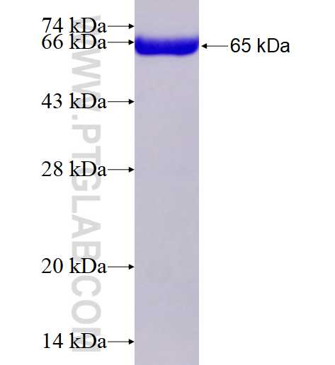 HUWE1 fusion protein Ag13763 SDS-PAGE