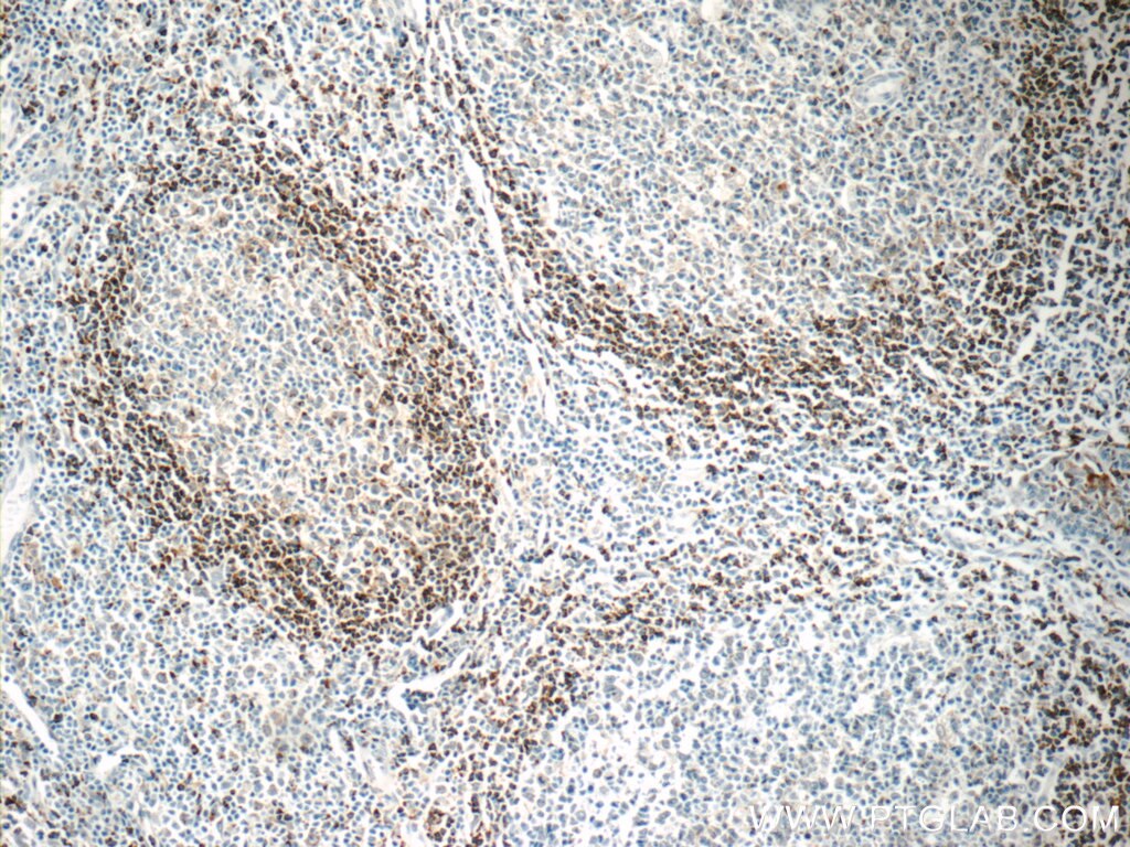 Immunohistochemistry (IHC) staining of human tonsillitis tissue using HVCN1 Polyclonal antibody (14162-1-AP)