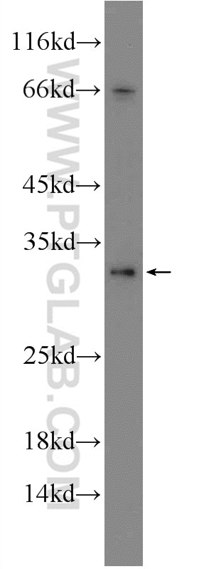 HVCN1