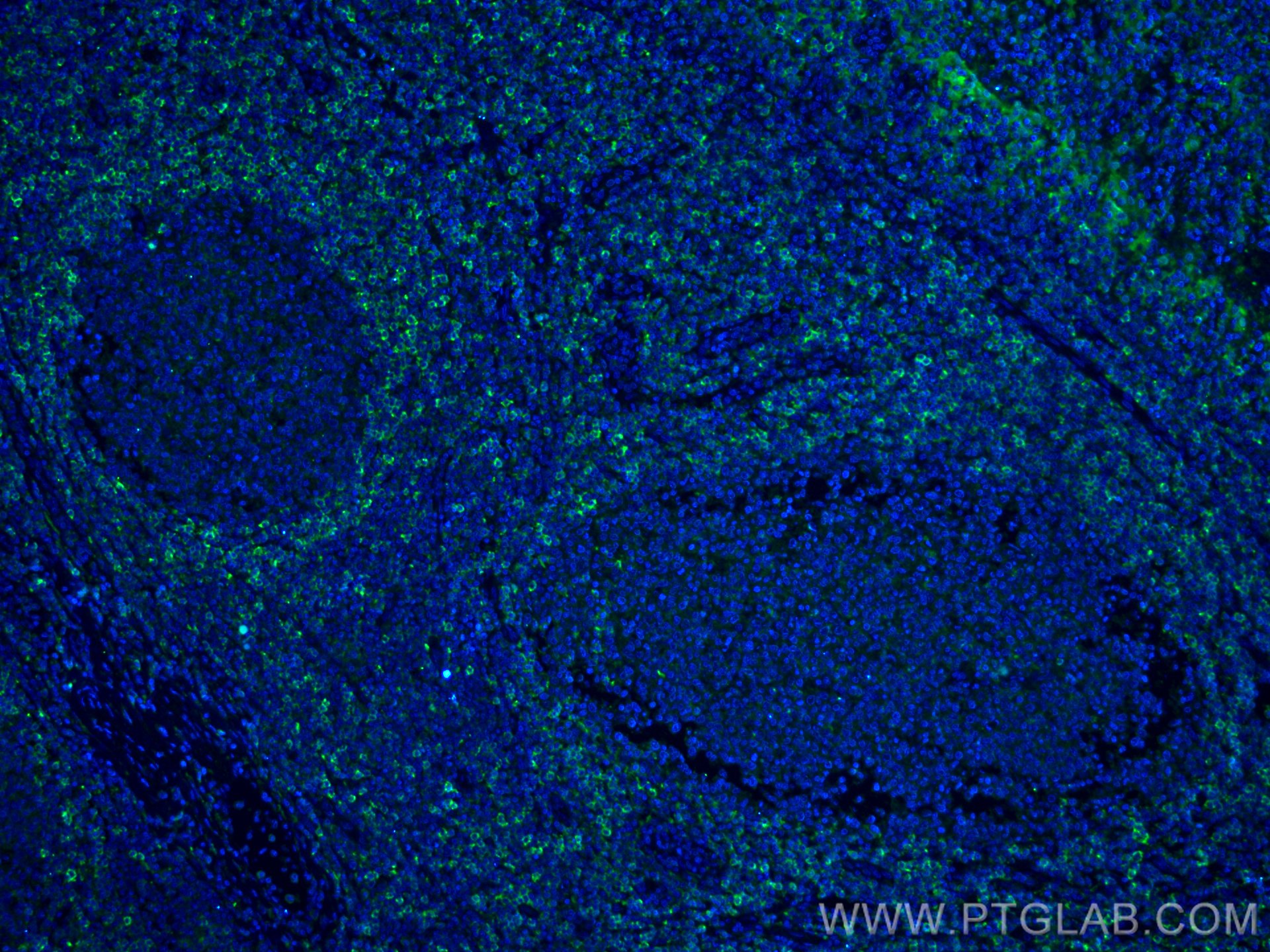 Immunofluorescence (IF) / fluorescent staining of human tonsillitis tissue using HVCN1 Monoclonal antibody (66449-1-Ig)