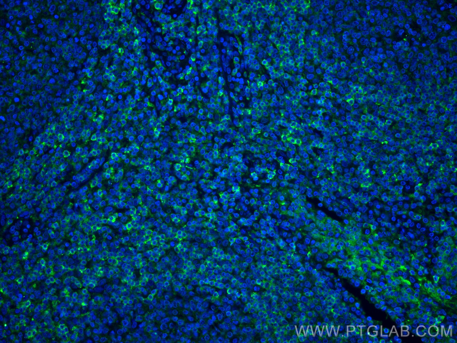 Immunofluorescence (IF) / fluorescent staining of human tonsillitis tissue using HVCN1 Monoclonal antibody (66449-1-Ig)