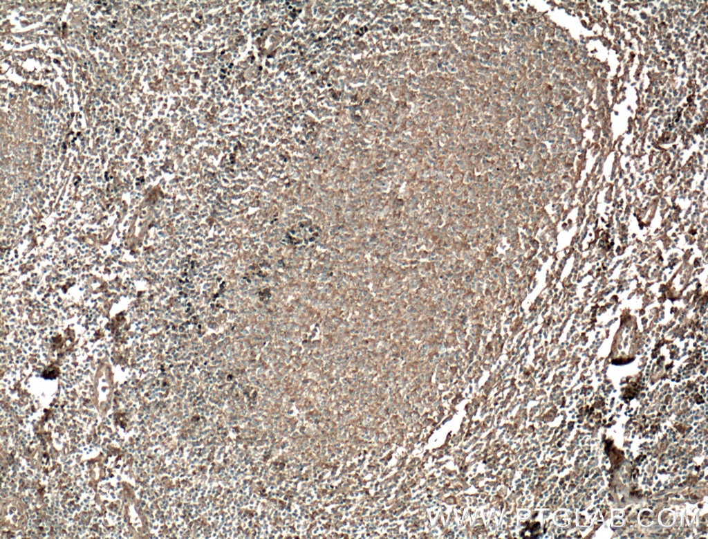Immunohistochemistry (IHC) staining of human tonsillitis tissue using HVCN1 Monoclonal antibody (66449-1-Ig)