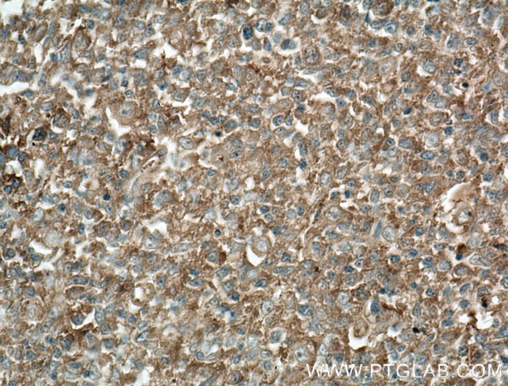 Immunohistochemistry (IHC) staining of human tonsillitis tissue using HVCN1 Monoclonal antibody (66449-1-Ig)