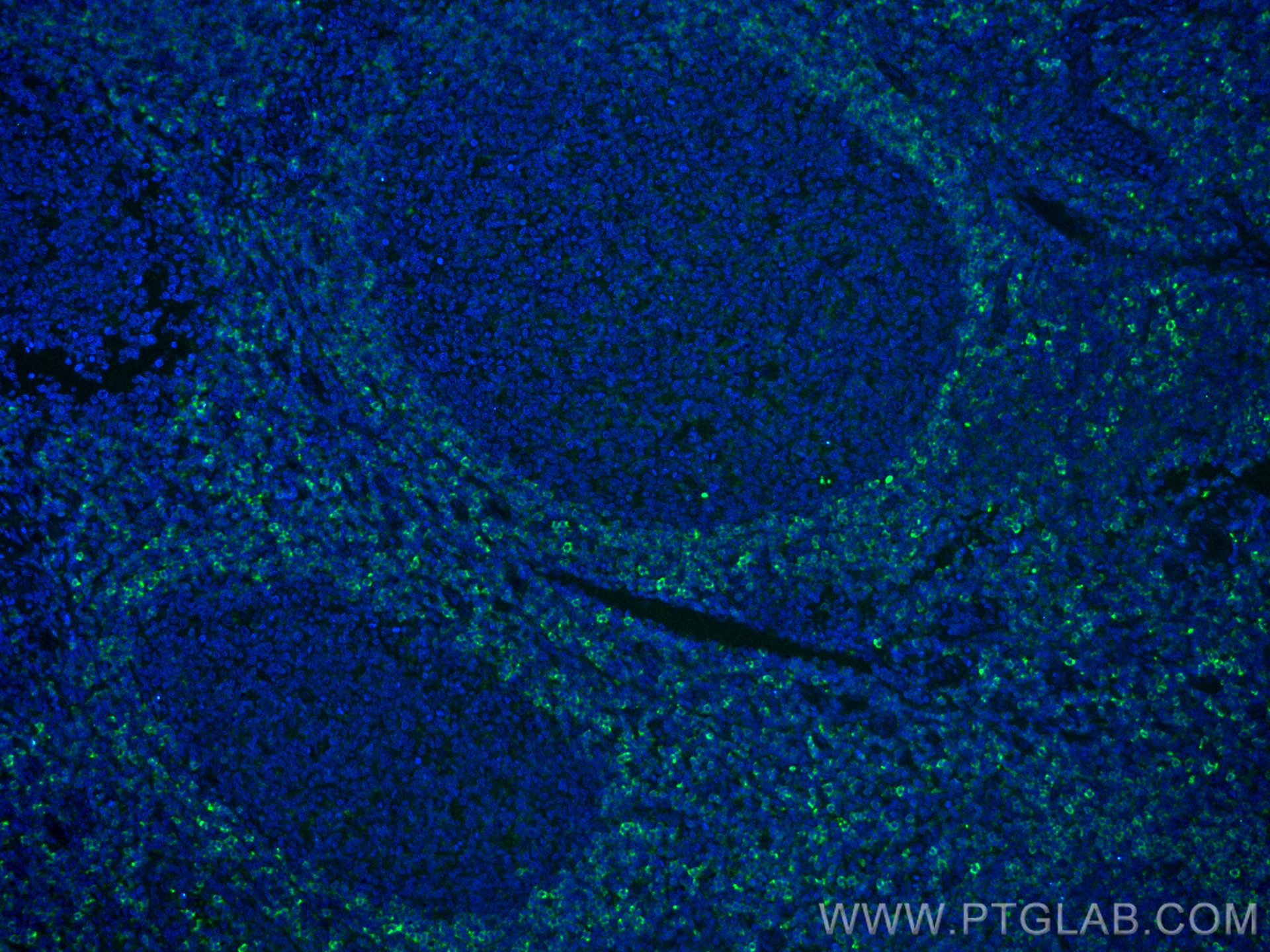 Immunofluorescence (IF) / fluorescent staining of human tonsillitis tissue using CoraLite® Plus 488-conjugated HVCN1 Monoclonal ant (CL488-66449)