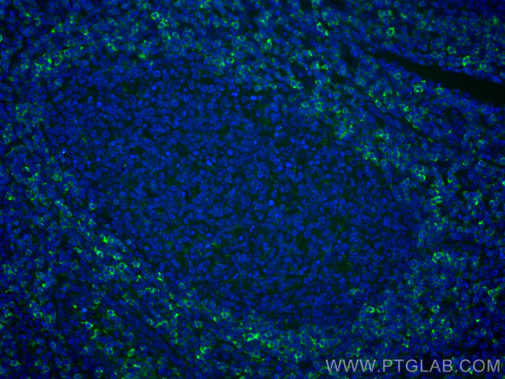 Immunofluorescence (IF) / fluorescent staining of human tonsillitis tissue using CoraLite® Plus 488-conjugated HVCN1 Monoclonal ant (CL488-66449)