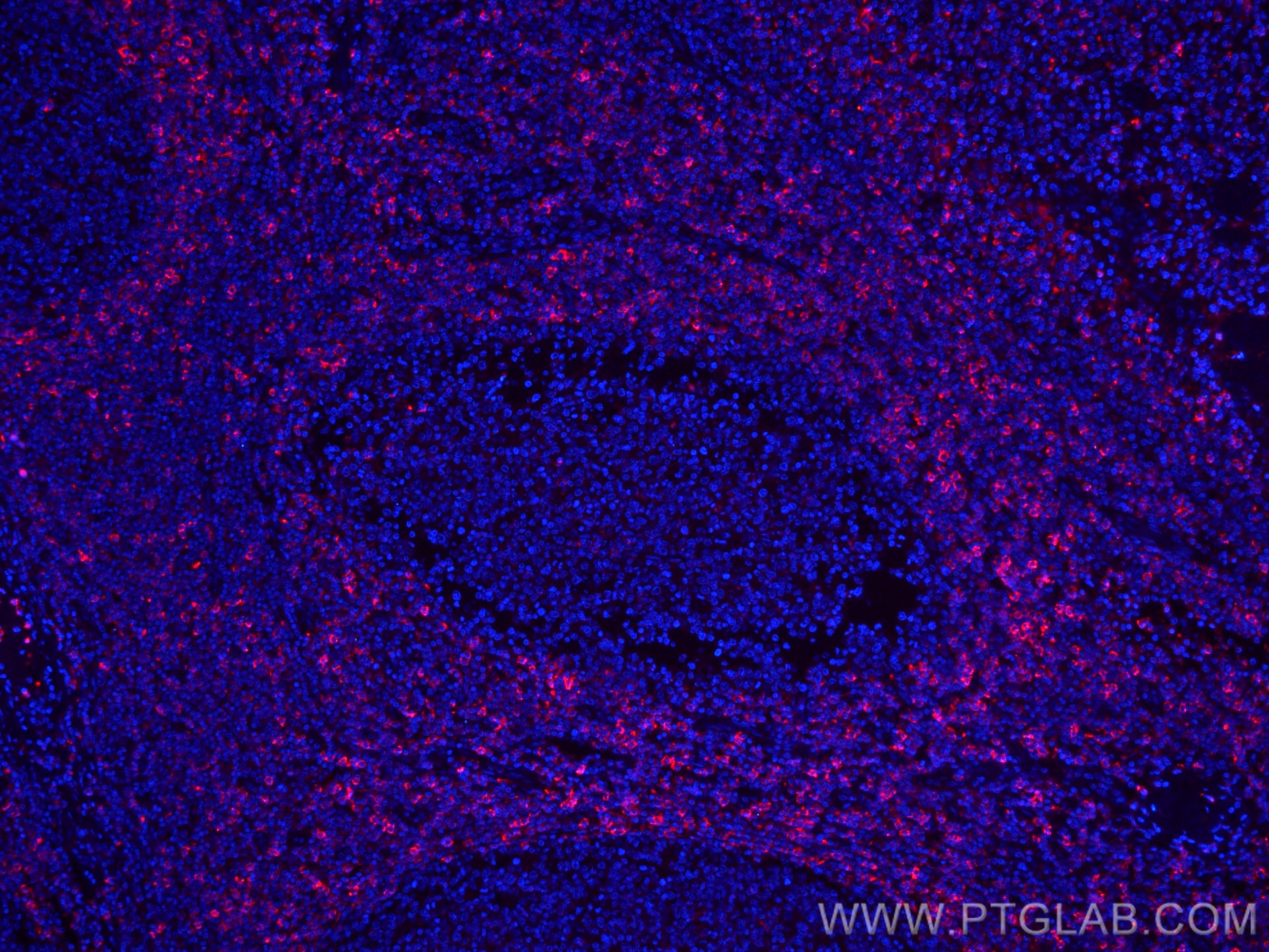 Immunofluorescence (IF) / fluorescent staining of human tonsillitis tissue using CoraLite®594-conjugated HVCN1 Monoclonal antibody (CL594-66449)