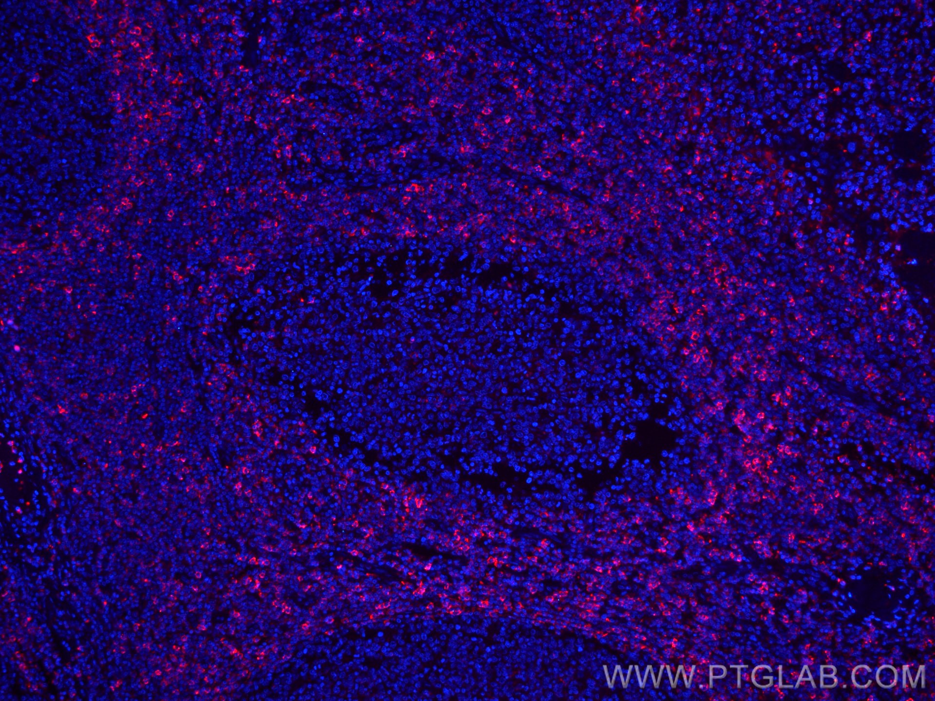 IF Staining of human tonsillitis using CL594-66449