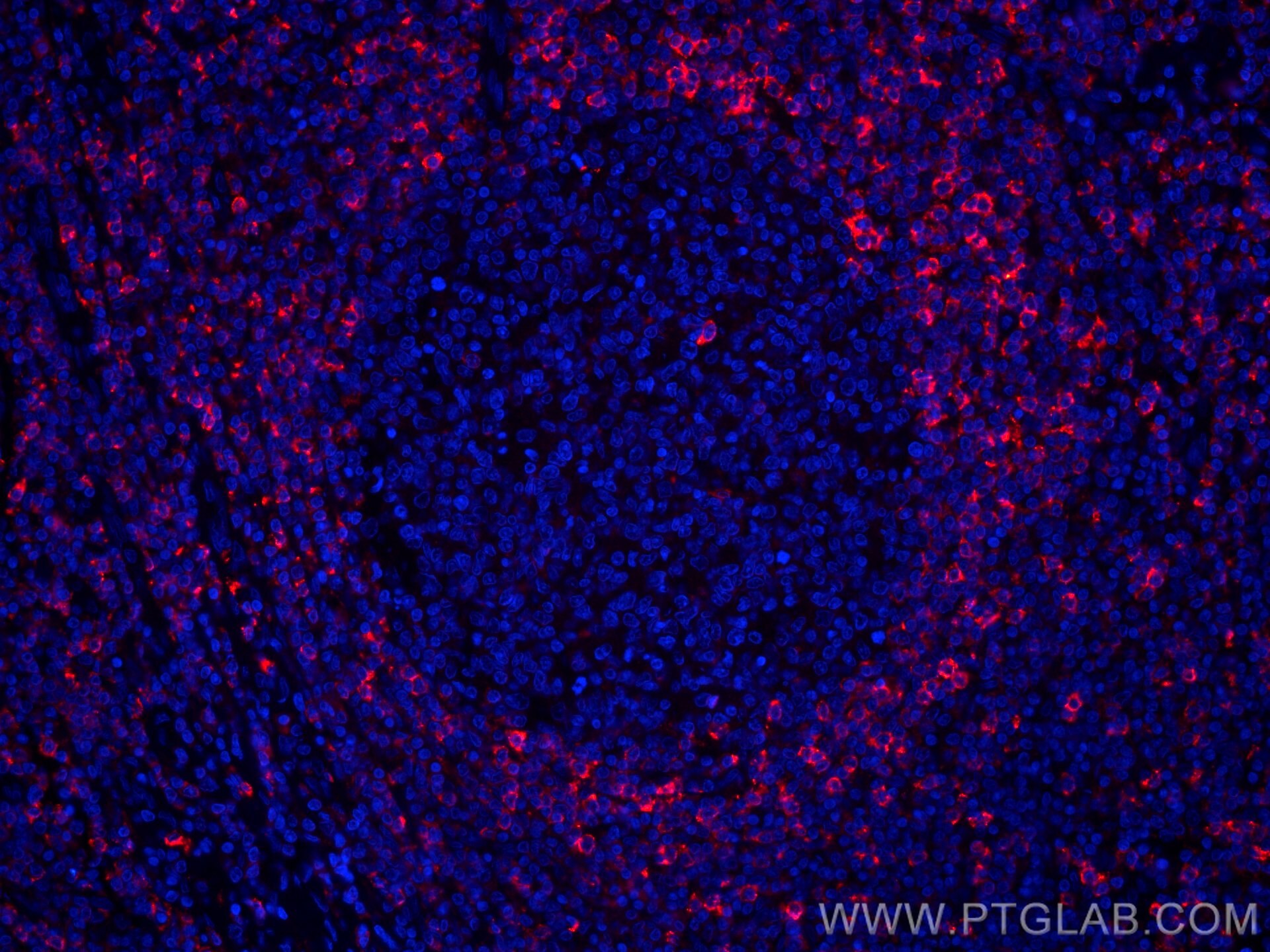 Immunofluorescence (IF) / fluorescent staining of human tonsillitis tissue using CoraLite®594-conjugated HVCN1 Monoclonal antibody (CL594-66449)