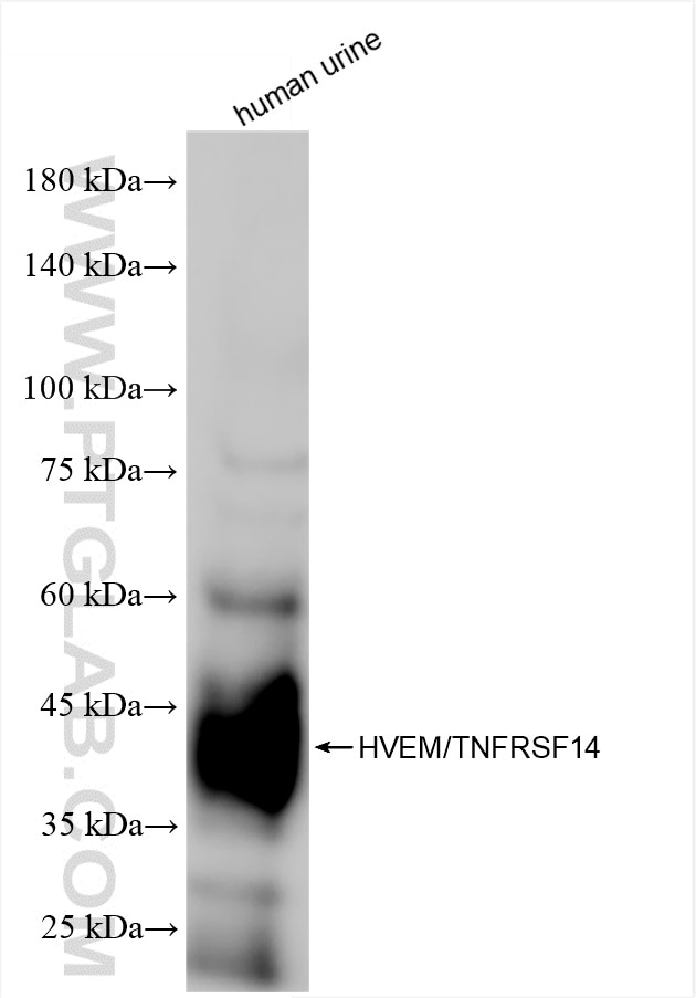 human urine sample was subjected to SDS PAGE followed by western blot with 81078-6-RR (HVEM/TNFRSF14 antibody) at dilution of 1:1000 incubated at room temperature for 1.5 hours. Western Blot (WB) analysis of human urine sample using HVEM/TNFRSF14 Recombinant antibody (81078-6-RR)
