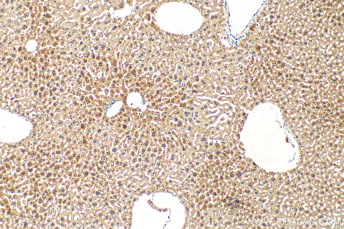 Immunohistochemistry (IHC) staining of mouse liver tissue using HYAL1 Polyclonal antibody (25179-1-AP)