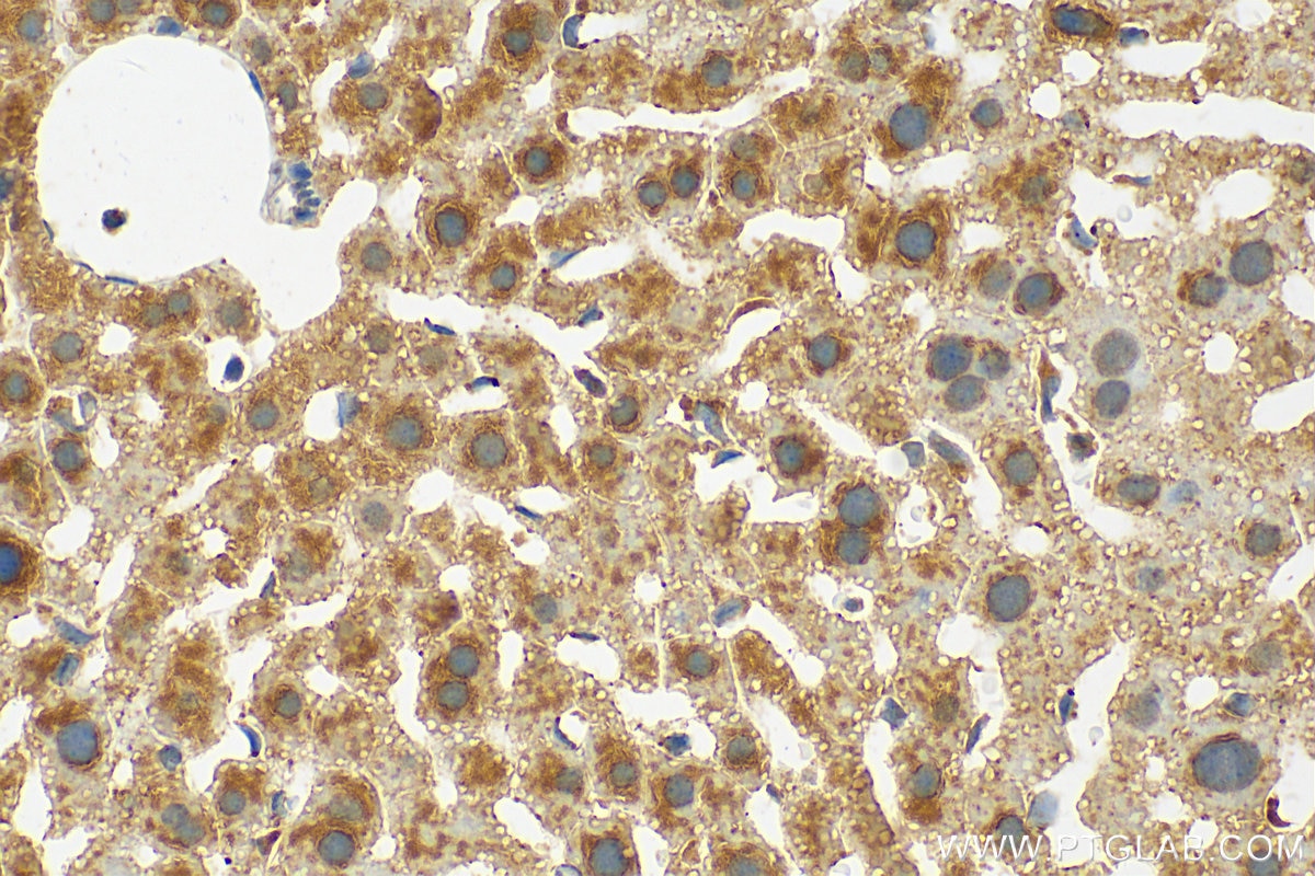 Immunohistochemistry (IHC) staining of mouse liver tissue using HYAL1 Polyclonal antibody (25179-1-AP)