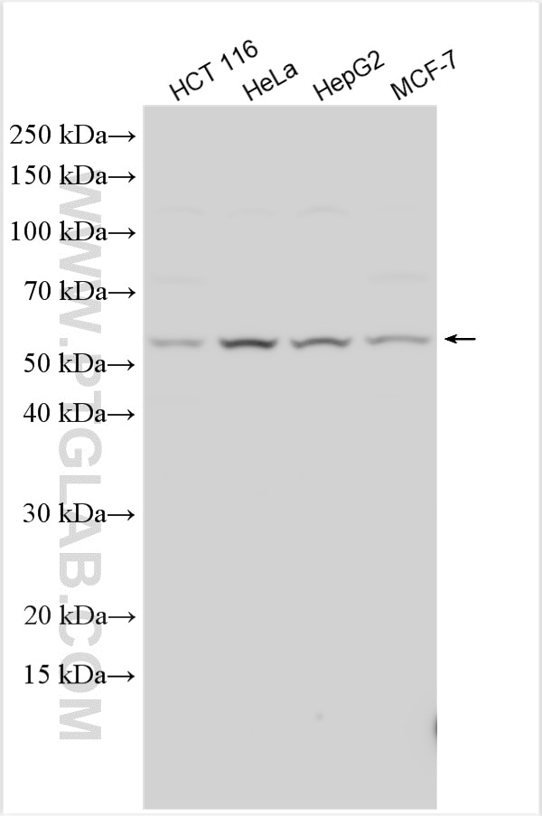 Western Blot (WB) analysis of various lysates using HYAL1 Polyclonal antibody (25179-1-AP)