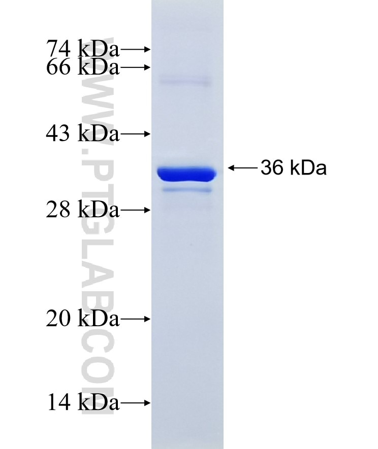 HYAL1 fusion protein Ag18183 SDS-PAGE