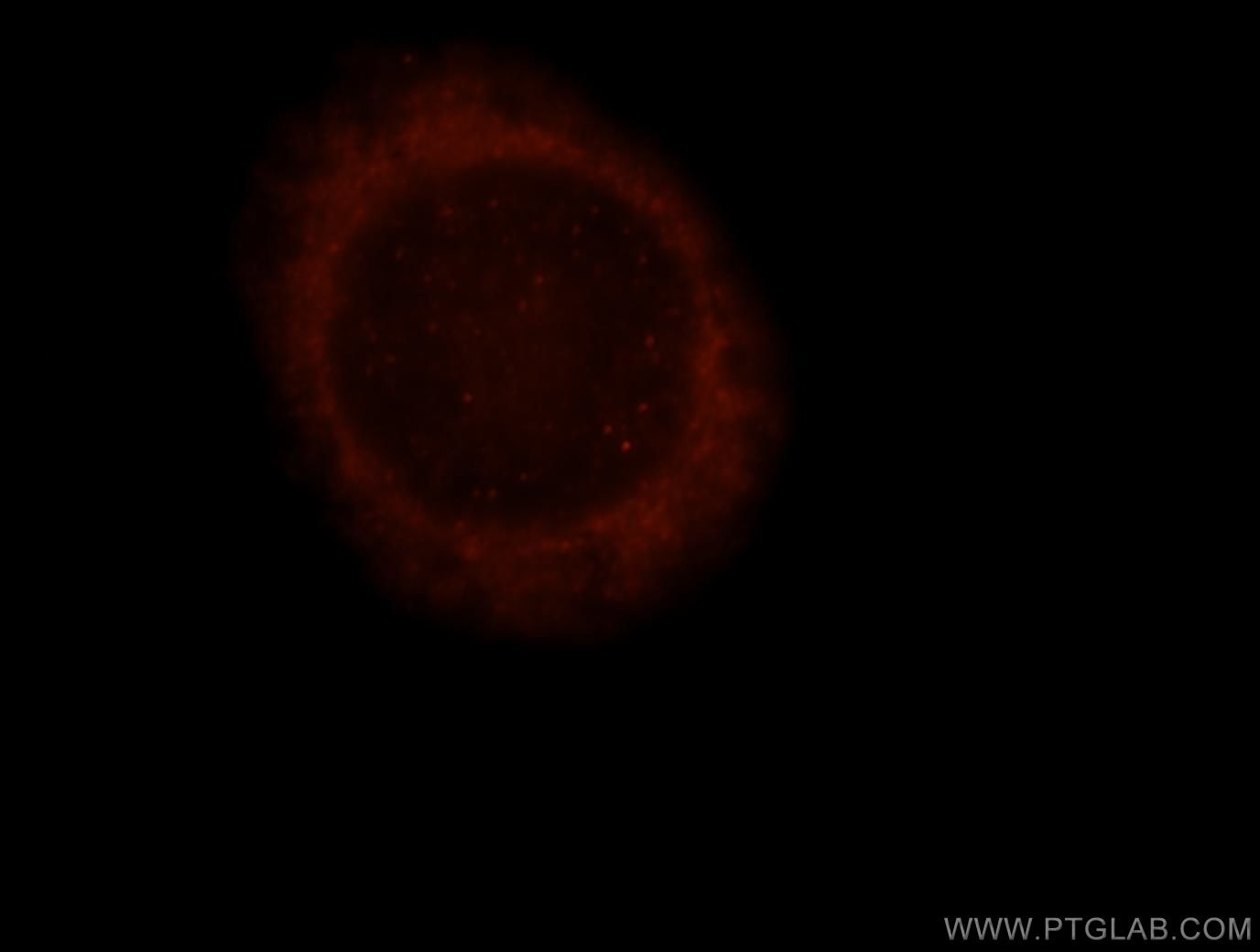 Immunofluorescence (IF) / fluorescent staining of HeLa cells using HYAL2 Polyclonal antibody (15115-1-AP)