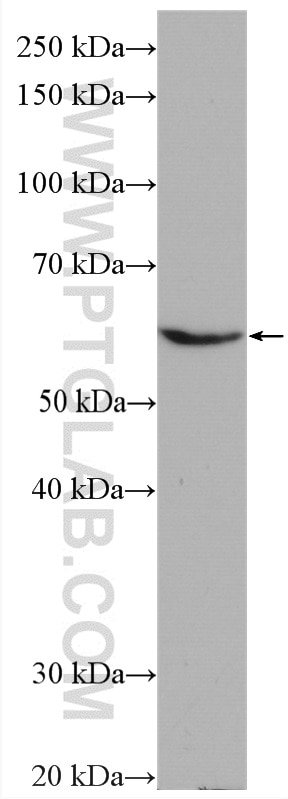 Western Blot (WB) analysis of Raji cells using HYAL2 Polyclonal antibody (15115-1-AP)