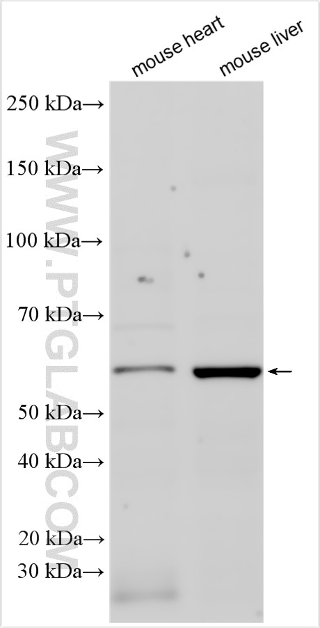 Western Blot (WB) analysis of various lysates using HYAL2 Polyclonal antibody (15115-1-AP)