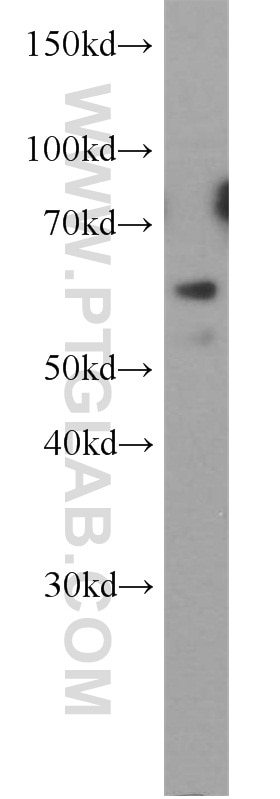 Western Blot (WB) analysis of HeLa cells using HYAL2 Polyclonal antibody (15115-1-AP)