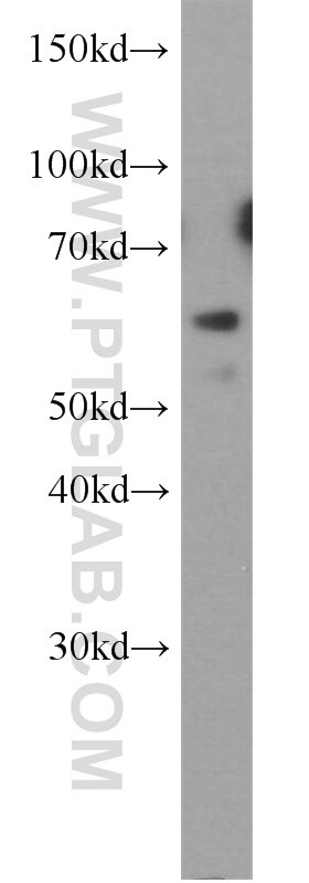 WB analysis of HeLa using 15115-1-AP