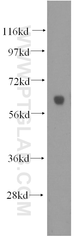Western Blot (WB) analysis of human heart tissue using HYAL2 Polyclonal antibody (51148-1-AP)
