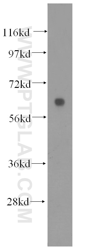 Western Blot (WB) analysis of human lung tissue using HYAL2 Polyclonal antibody (51148-1-AP)