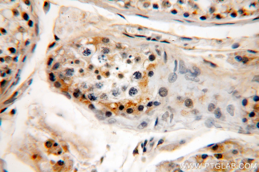 Immunohistochemistry (IHC) staining of human testis tissue using HYAL3 Polyclonal antibody (19625-1-AP)