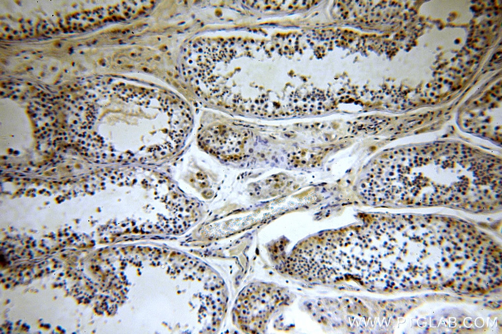 Immunohistochemistry (IHC) staining of human testis tissue using HYAL3 Polyclonal antibody (19625-1-AP)