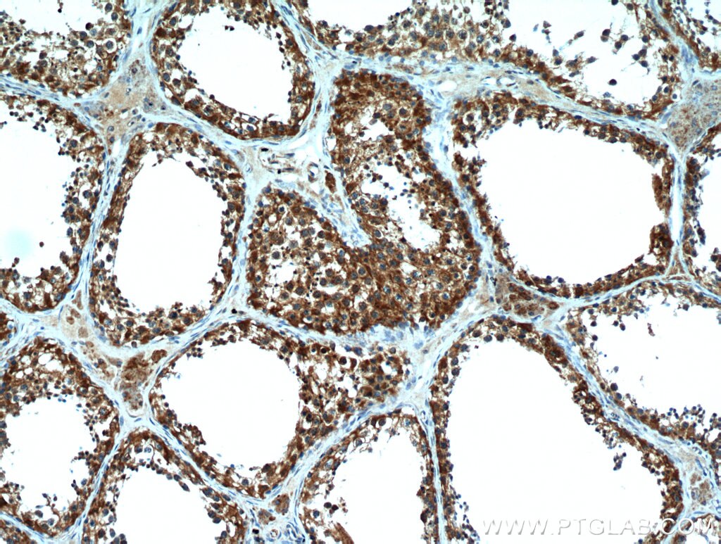 Immunohistochemistry (IHC) staining of human testis tissue using HYAL3 Polyclonal antibody (19625-1-AP)