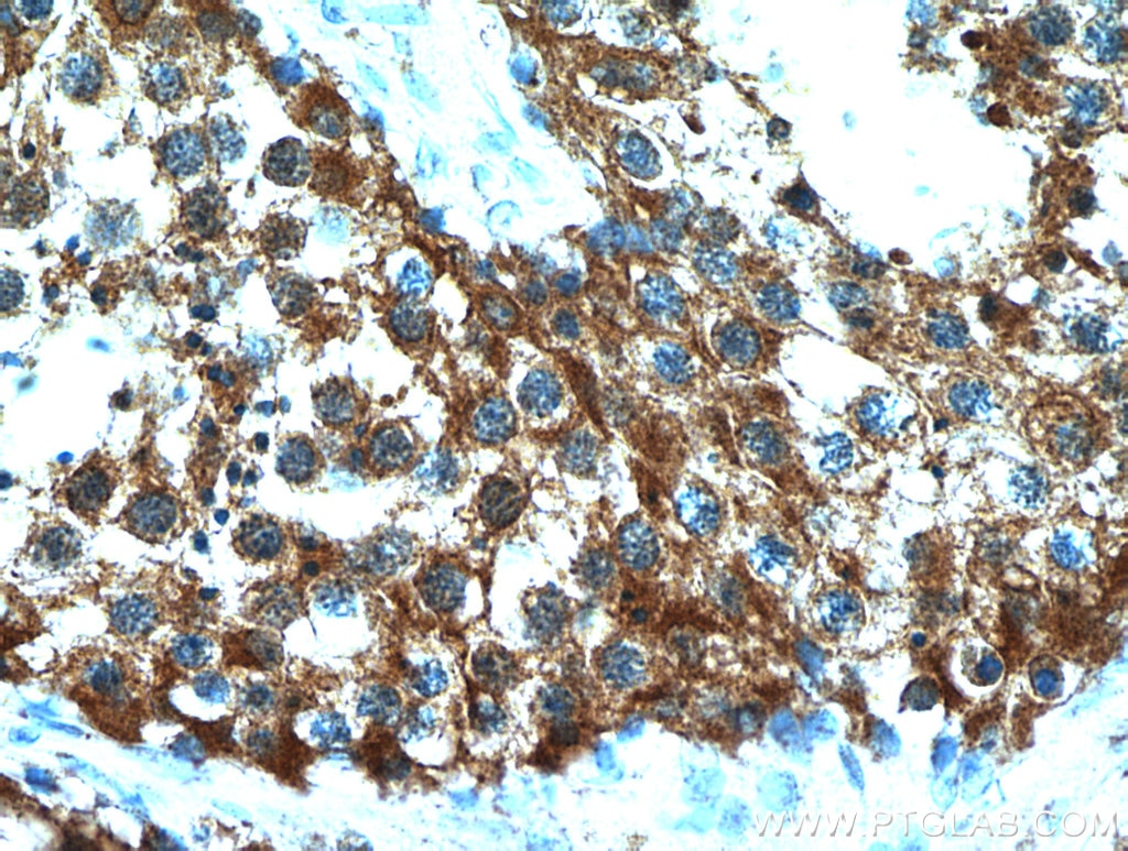 Immunohistochemistry (IHC) staining of human testis tissue using HYAL3 Polyclonal antibody (19625-1-AP)