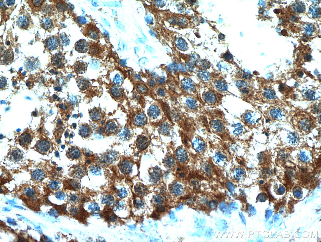 IHC staining of human testis using 19625-1-AP