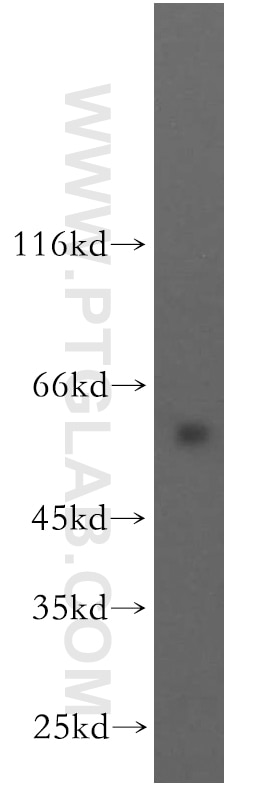 Western Blot (WB) analysis of human brain tissue using HYAL3 Polyclonal antibody (19625-1-AP)