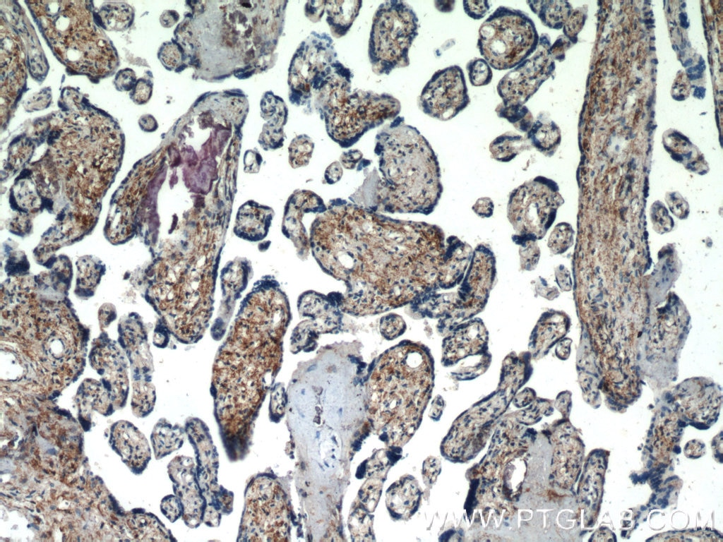 Immunohistochemistry (IHC) staining of human placenta tissue using HYAL4 Polyclonal antibody (18139-1-AP)