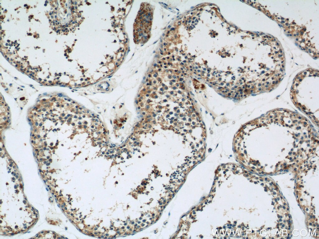 Immunohistochemistry (IHC) staining of human testis tissue using HYAL4 Polyclonal antibody (18139-1-AP)