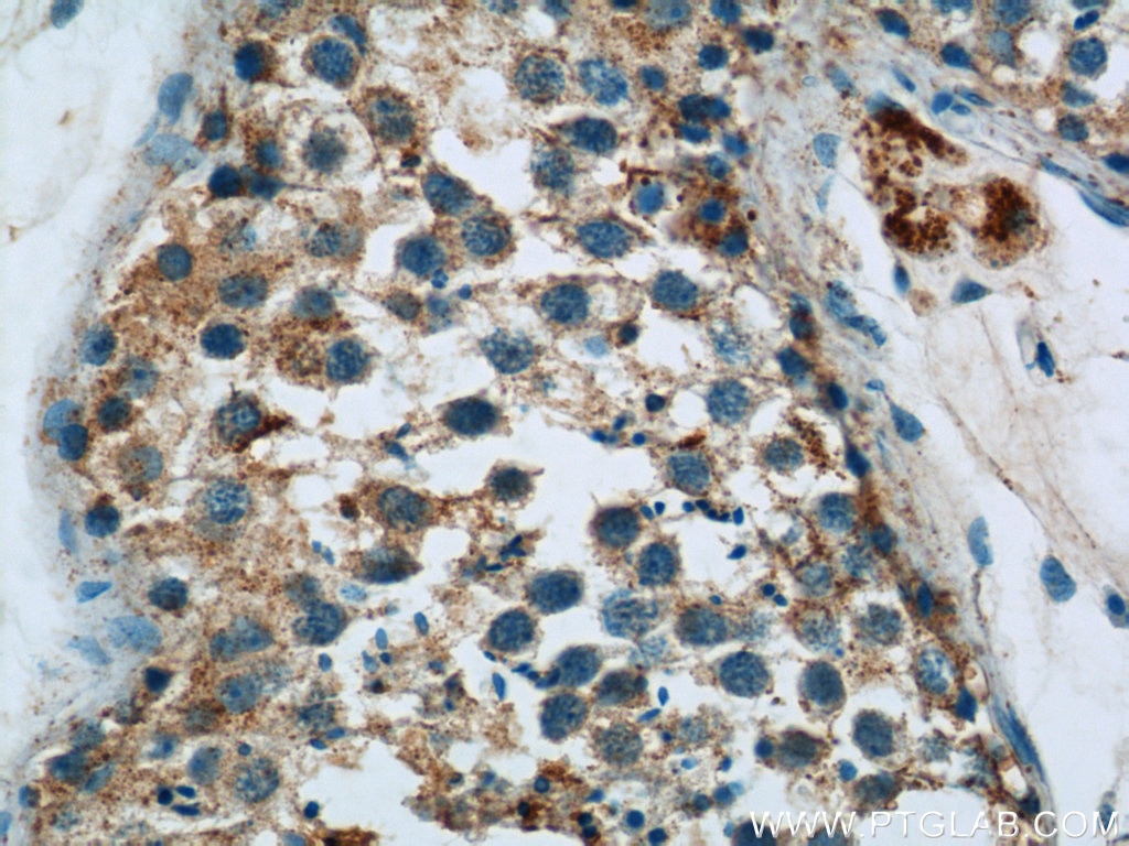 Immunohistochemistry (IHC) staining of human testis tissue using HYAL4 Polyclonal antibody (18139-1-AP)