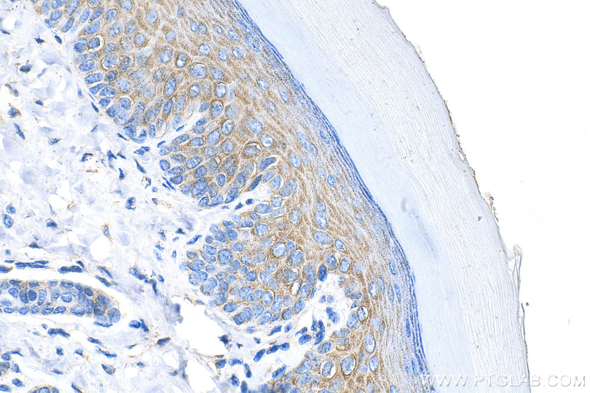 Immunohistochemistry (IHC) staining of mouse skin tissue using HYAL4 Polyclonal antibody (18139-1-AP)