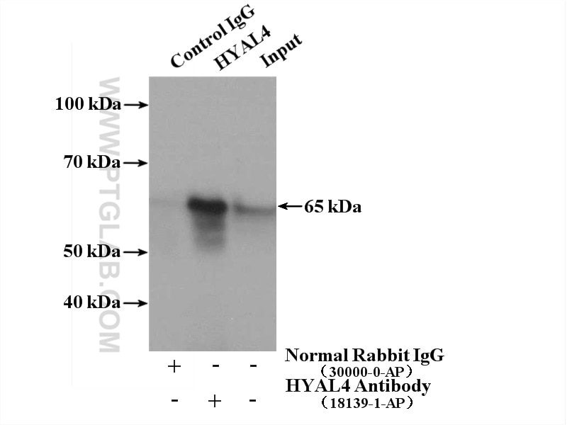 Immunoprecipitation (IP) experiment of mouse testis tissue using HYAL4 Polyclonal antibody (18139-1-AP)