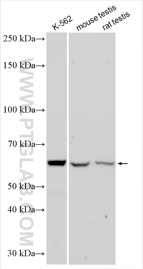 Western Blot (WB) analysis of various lysates using HYAL4 Polyclonal antibody (18139-1-AP)