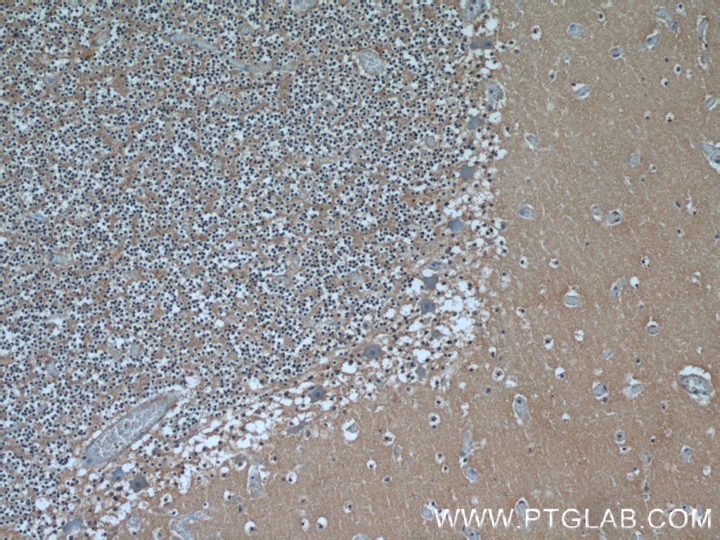 Immunohistochemistry (IHC) staining of human cerebellum tissue using HYDIN Polyclonal antibody (24741-1-AP)