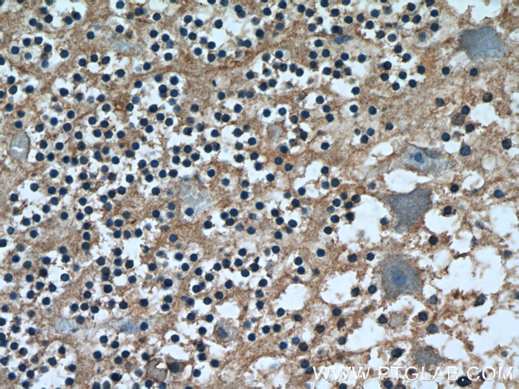 Immunohistochemistry (IHC) staining of human cerebellum tissue using HYDIN Polyclonal antibody (24741-1-AP)