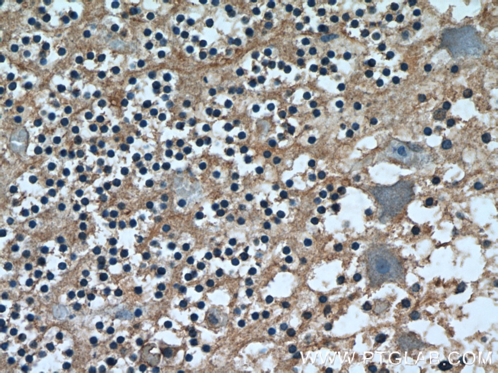 IHC staining of human cerebellum using 24741-1-AP