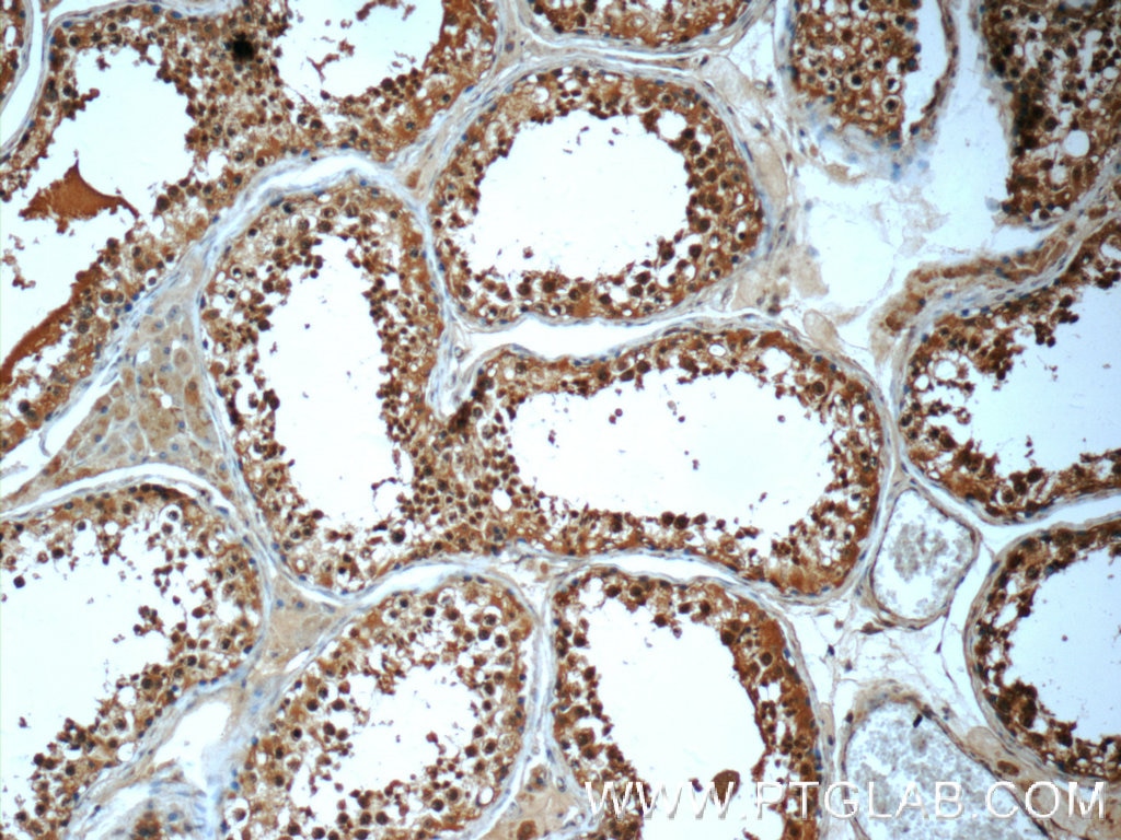 IHC staining of human testis using 24741-1-AP