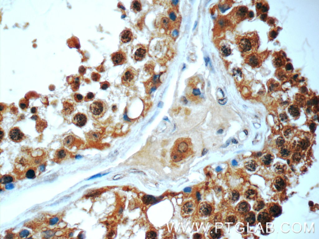 Immunohistochemistry (IHC) staining of human testis tissue using HYDIN Polyclonal antibody (24741-1-AP)