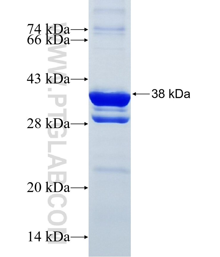 HYLS1 fusion protein Ag8306 SDS-PAGE