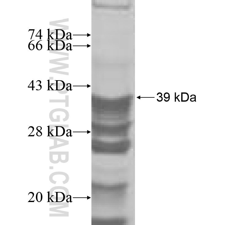 HYLS1 fusion protein Ag8306 SDS-PAGE