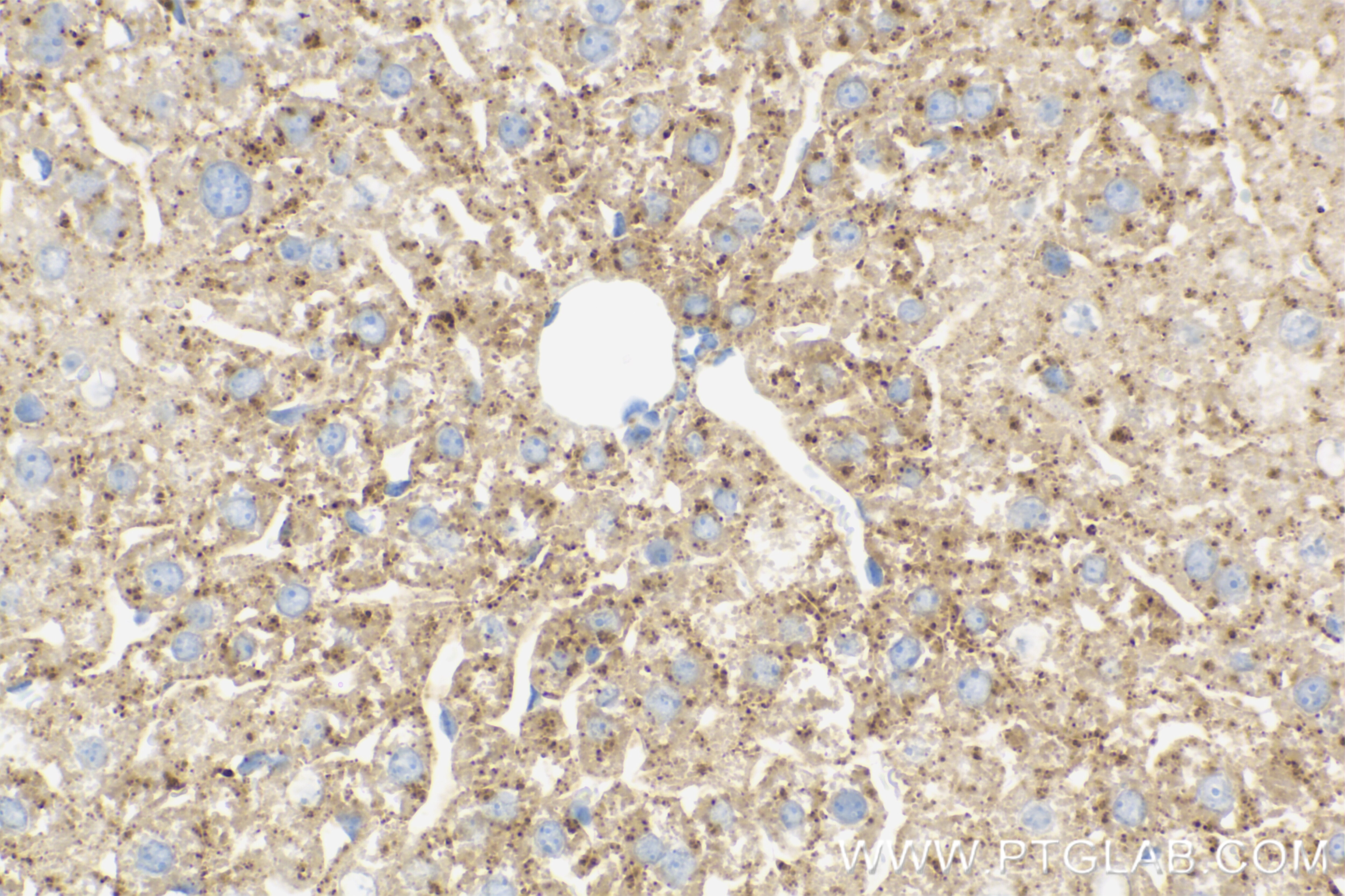Immunohistochemistry (IHC) staining of mouse liver tissue using Haptoglobin Recombinant antibody (83702-5-RR)
