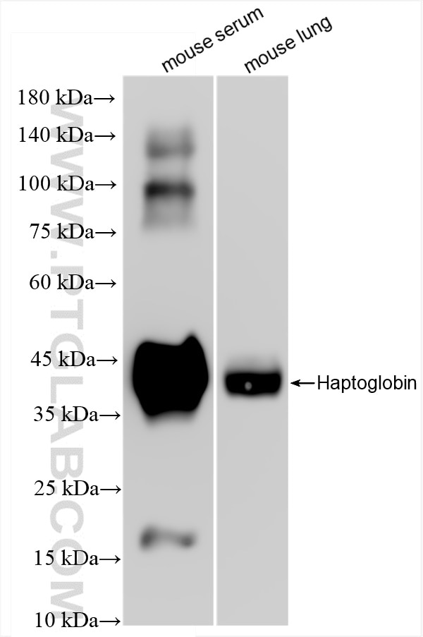 Western Blot (WB) analysis of various lysates using Haptoglobin Recombinant antibody (83702-5-RR)