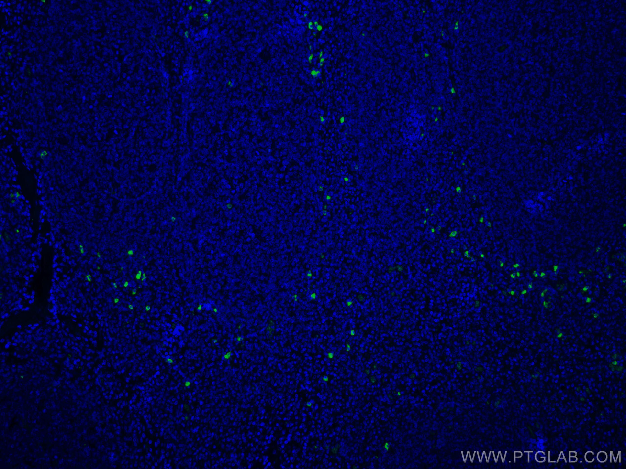 Immunofluorescence (IF) / fluorescent staining of human tonsillitis tissue using CoraLite®488-conjugated Human IgG4 Monoclonal anti (CL488-66408)