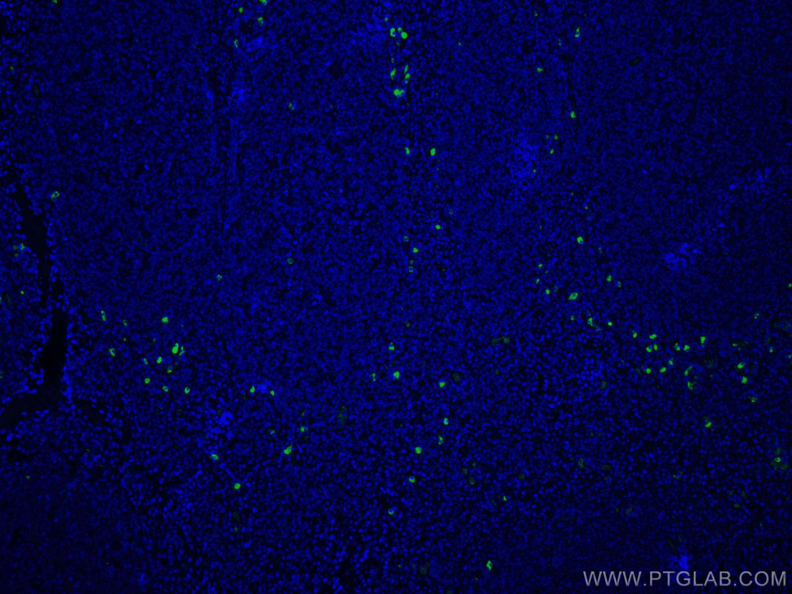 IF Staining of human tonsillitis using CL488-66408