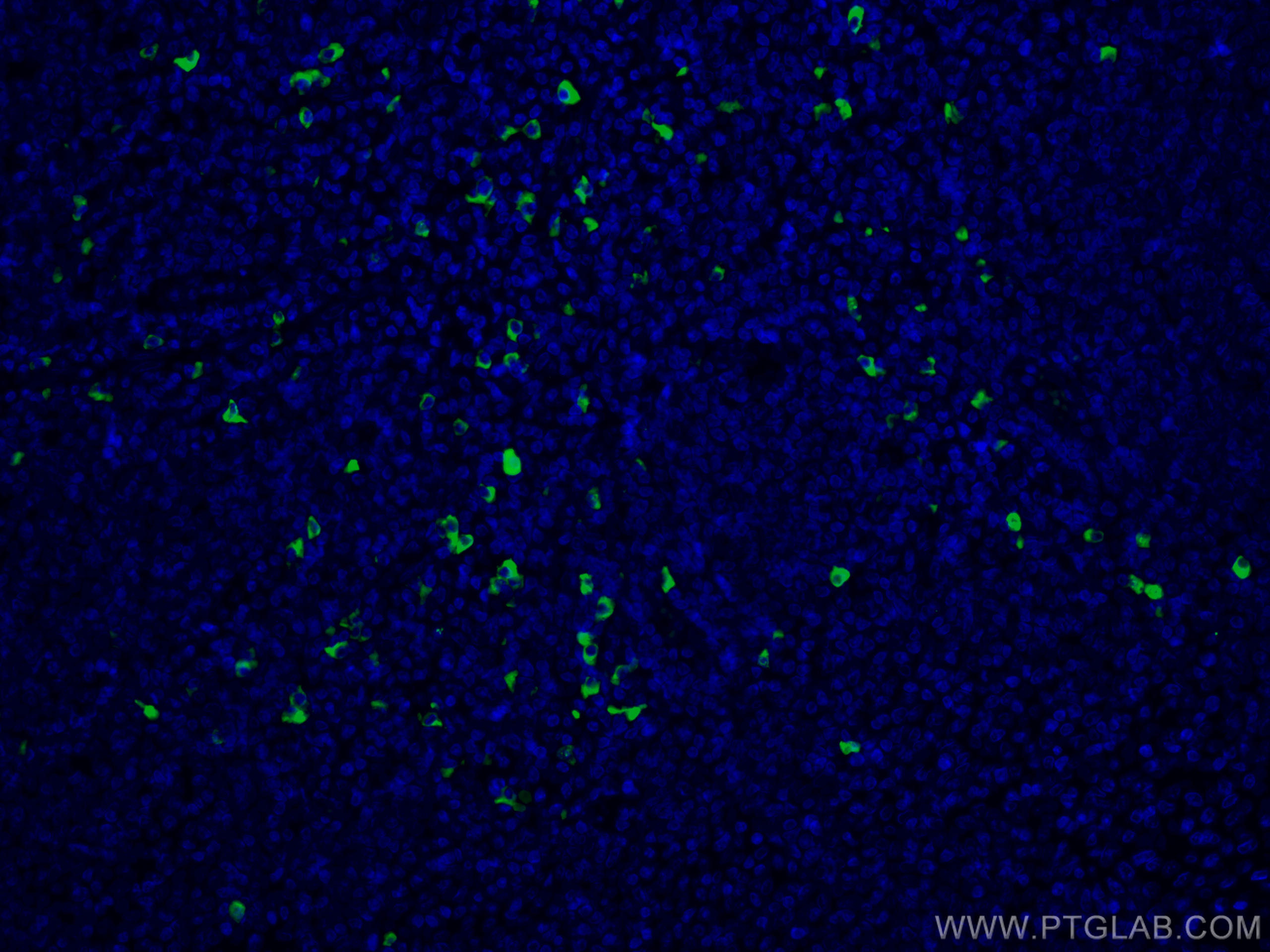 Immunofluorescence (IF) / fluorescent staining of human tonsillitis tissue using CoraLite®488-conjugated Human IgG4 Monoclonal anti (CL488-66408)