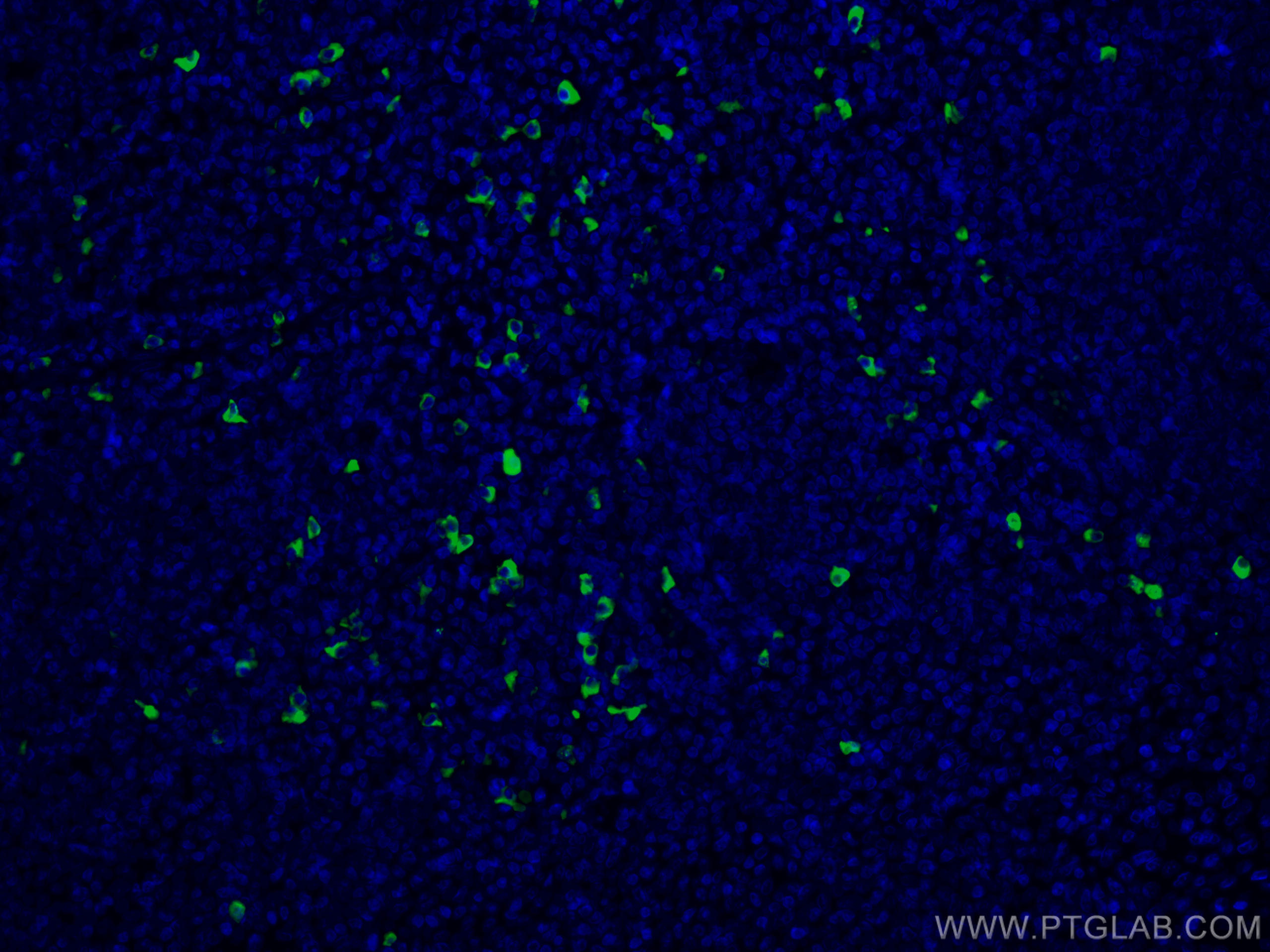 IF Staining of human tonsillitis using CL488-66408