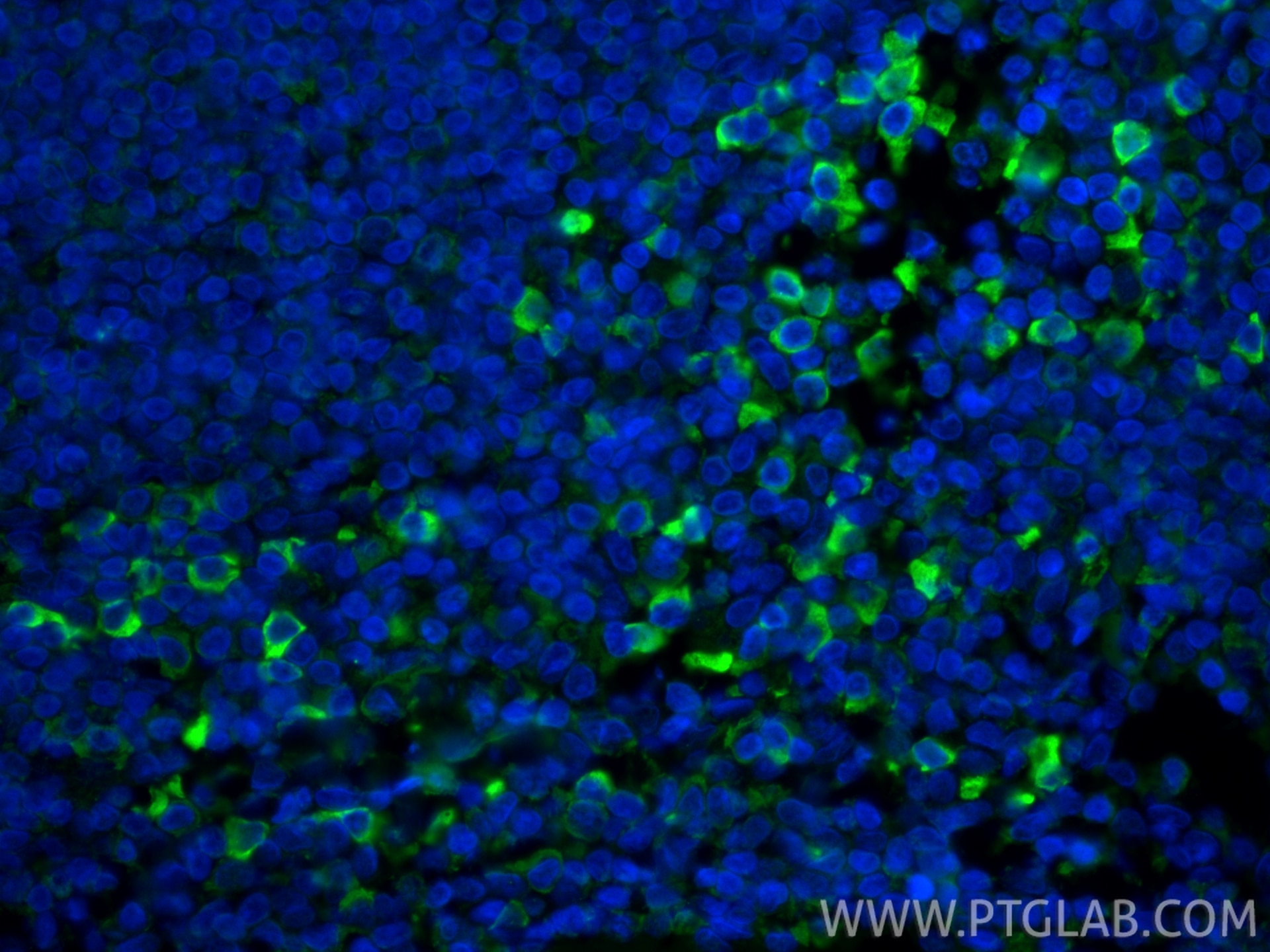 IF Staining of human tonsillitis using CL488-66408 Immunofluorescence (IF) / fluorescent staining of human tonsillitis tissue using CoraLite® Plus 488-conjugated Human IgG4 Monoclona (CL488-66408)